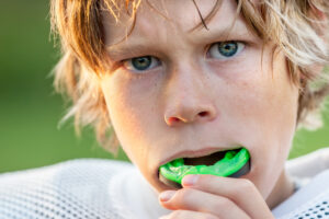 athletic mouth guards near severna park maryland Dr. Brian Valle dds Dentist in Millersville maryland