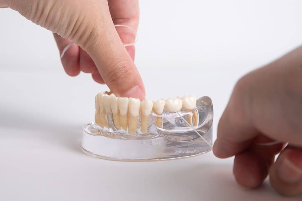 dental bridges millersville