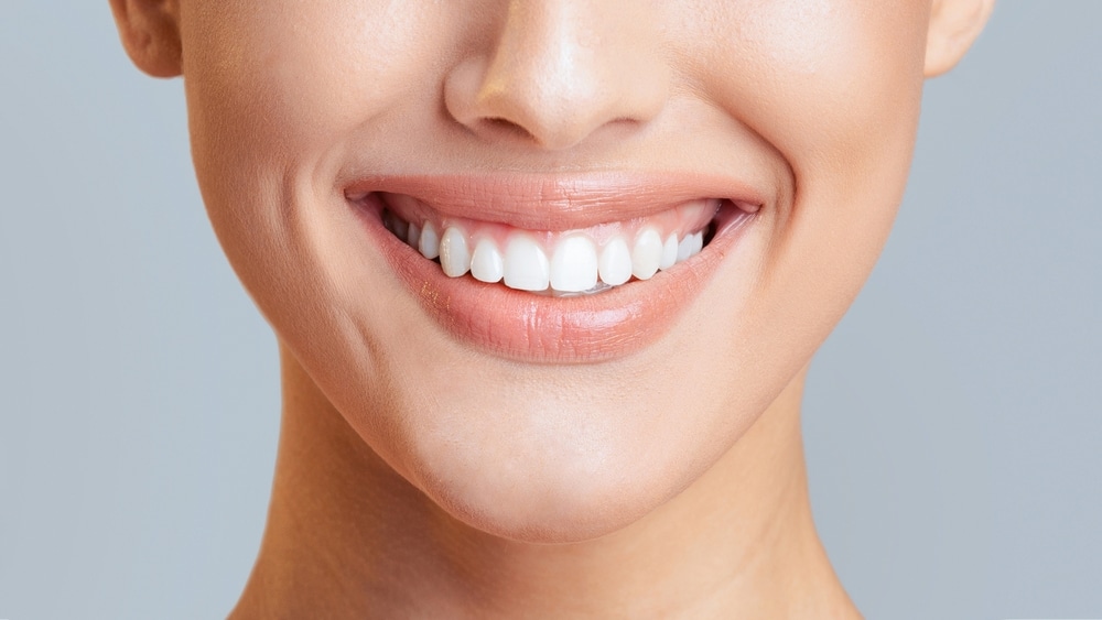 Get That Camera-Ready Smile with Teeth Whitening in Millersville